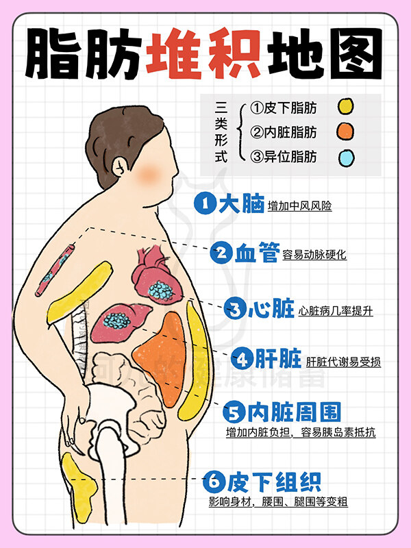 了解脂肪堆积地图